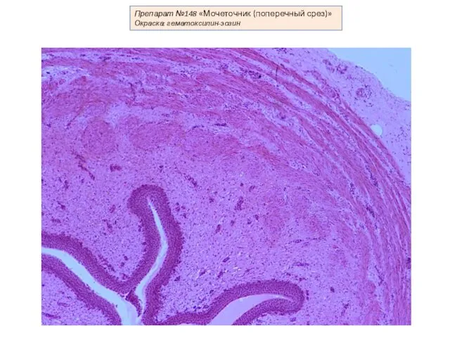 Препарат №148 «Мочеточник (поперечный срез)» Окраска: гематоксилин-эозин