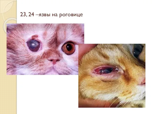 23, 24 –язвы на роговице