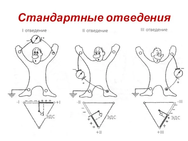 Стандартные отведения