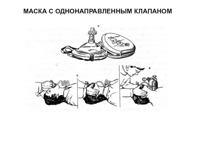 МАСКА С ОДНОНАПРАВЛЕННЫМ КЛАПАНОМ