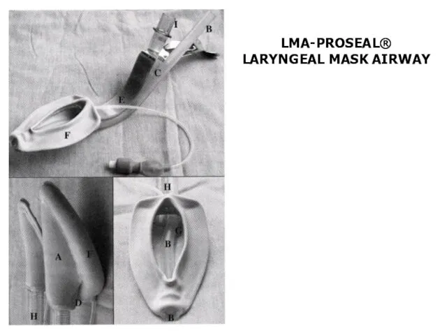 LMA-PROSEAL® LARYNGEAL MASK AIRWAY