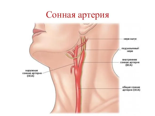 Сонная артерия