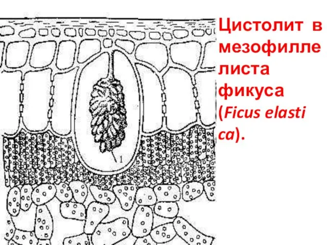 Цистолит в мезофилле листа фикуса (Ficus elasti ca).
