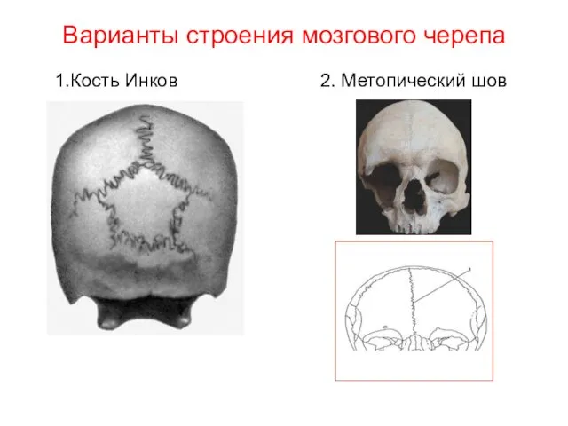 Варианты строения мозгового черепа 1.Кость Инков 2. Метопический шов