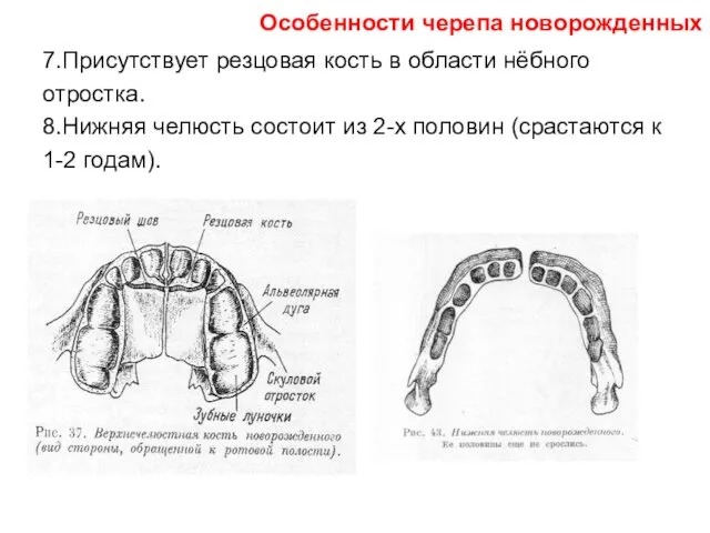 7.Присутствует резцовая кость в области нёбного отростка. 8.Нижняя челюсть состоит из