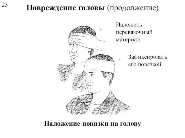 Повреждение головы (продолжение) Наложение повязки на голову Наложить перевязочный материал Зафиксировать его повязкой 23