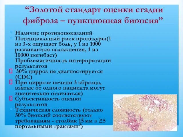 “Золотой стандарт оценки стадии фиброза – пункционная биопсия” Наличие противопоказаний Потенциальный