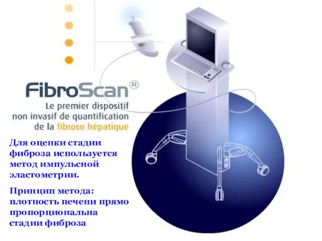 Для оценки стадии фиброза используется метод импульсной эластометрии. Принцип метода: плотность печени прямо пропорциональна стадии фиброза