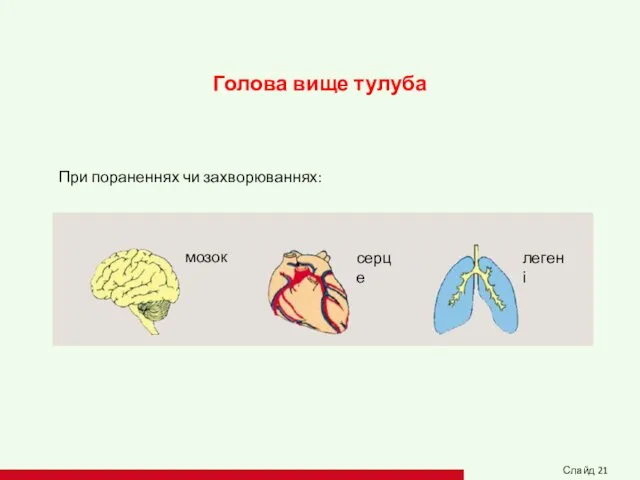 Голова вище тулуба При пораненнях чи захворюваннях: мозок серце легені Слайд 21