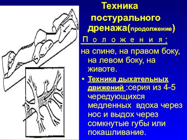 Техника постурального дренажа(продолжение) Положения: на спине, на правом боку, на левом