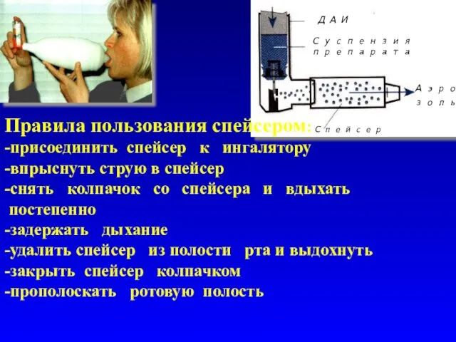 ДАИ Спейсер Аэрозоль Суспензия препарата Правила пользования спейсером: -присоединить спейсер к