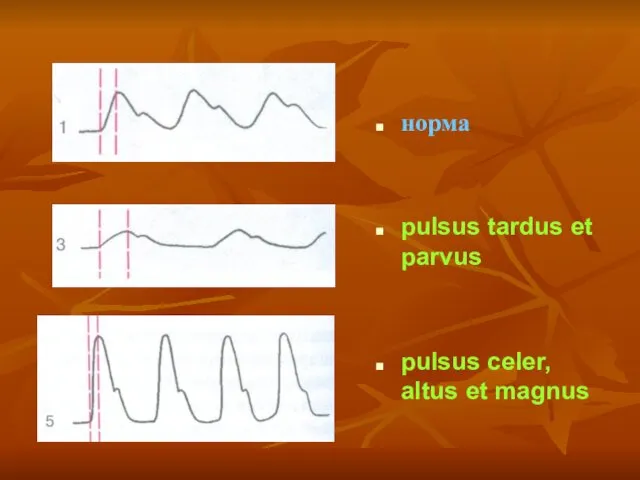 норма pulsus tardus et parvus pulsus celer, altus et magnus