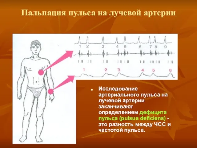 Пальпация пульса на лучевой артерии Исследование артериального пульса на лучевой артерии