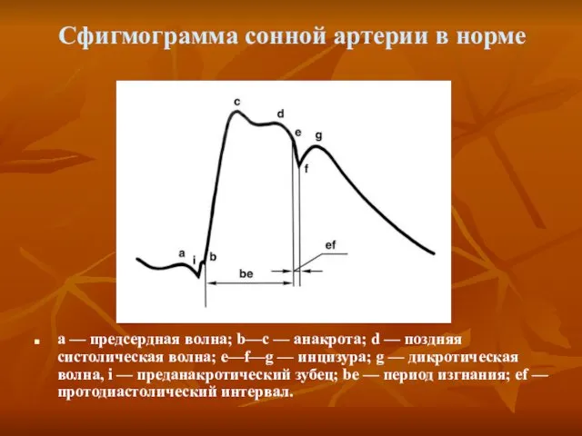 Сфигмограмма сонной артерии в норме а — предсердная волна; b—с —