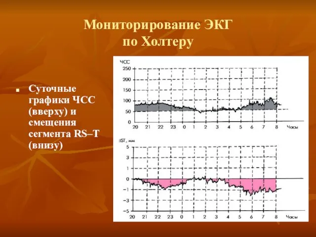 Мониторирование ЭКГ по Холтеру Суточные графики ЧСС (вверху) и смещения сегмента RS–T (внизу)