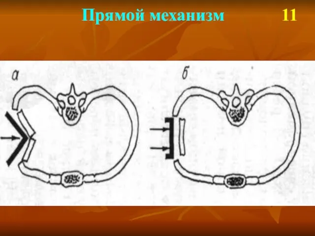 Прямой механизм 11