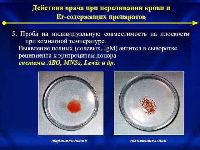 5. Проба на индивидуальную совместимость на плоскости при комнатной температуре. Выявление