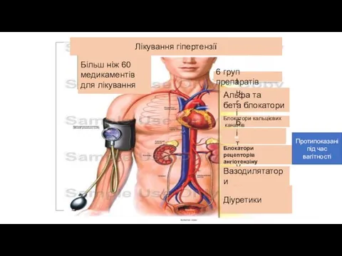 Лікування гіпертензії Більш ніж 60 медикаментів для лікування 6 груп препаратів