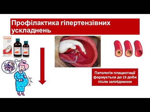 Профілактика гіпертензівних ускладнень Патологія плацентації формується до 19 доби після запліднення