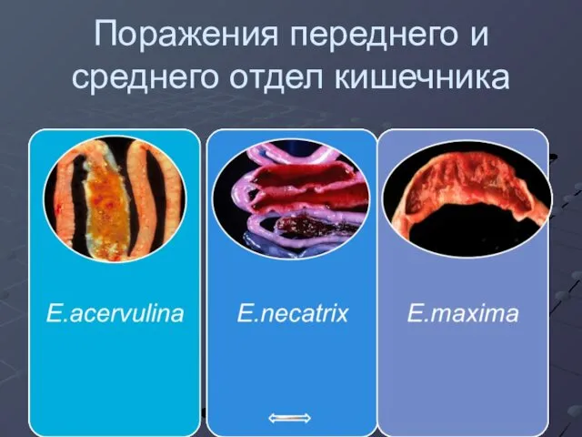 Поражения переднего и среднего отдел кишечника