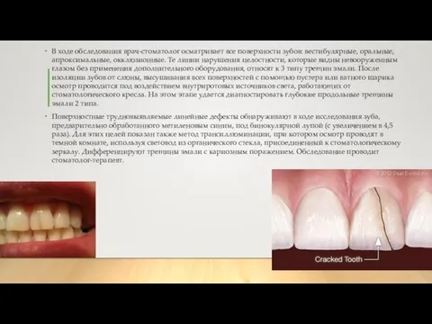 В ходе обследования врач-стоматолог осматривает все поверхности зубов: вестибулярные, оральные, апроксимальные,