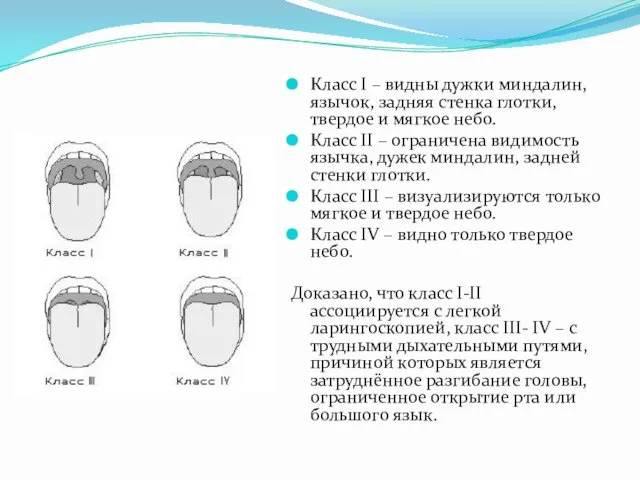 Класс І – видны дужки миндалин, язычок, задняя стенка глотки, твердое