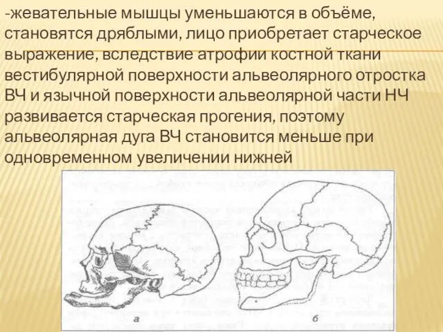 -жевательные мышцы уменьшаются в объёме, становятся дряблыми, лицо приобретает старческое выражение,