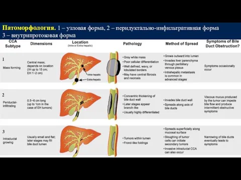 Патоморфология. 1 – узловая форма, 2 – перидуктально-инфильтративная форма 3 – внутрипротоковая форма 1 2 3