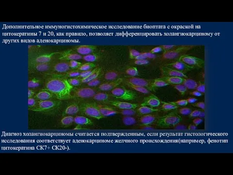 Диагноз холангиокарциномы считается подтвержденным, если результат гистологического исследования соответствует аденокарциноме желчного