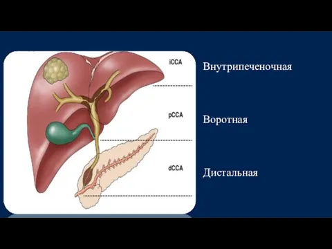 Внутрипеченочная Воротная Дистальная