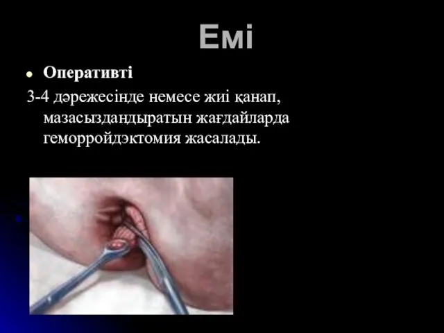 Емі Оперативті 3-4 дәрежесінде немесе жиі қанап, мазасыздандыратын жағдайларда геморройдэктомия жасалады.