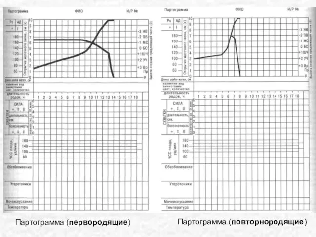 Партограмма (первородящие) Партограмма (повторнородящие)