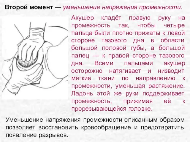 Акушер кладёт правую руку на промежность так, чтобы четыре пальца были