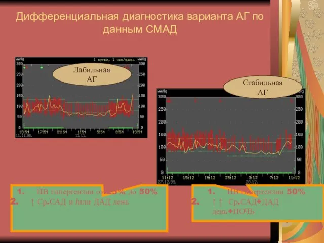 Дифференциальная диагностика варианта АГ по данным СМАД Лабильная АГ Стабильная АГ