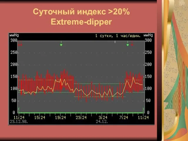 Суточный индекс >20% Extreme-dipper