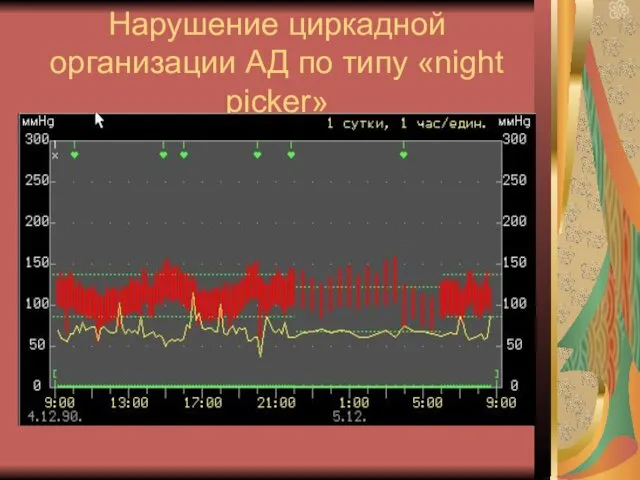 Нарушение циркадной организации АД по типу «night picker»