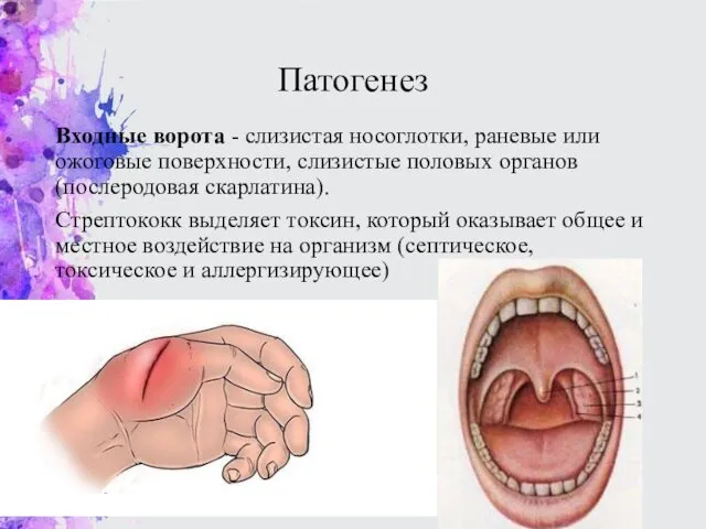 Патогенез Входные ворота - слизистая носоглотки, раневые или ожоговые поверхности, слизистые