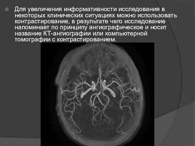 Для увеличения информативности исследования в некоторых клинических ситуациях можно использовать контрастирование,