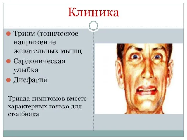 Клиника Тризм (тоническое напряжение жевательных мышц Сардоническая улыбка Дисфагия Триада симптомов вместе характерных только для столбняка