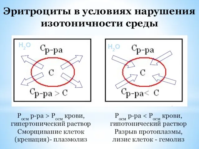 Эритроциты в условиях нарушения изотоничности среды Росм р-ра > Росм крови,