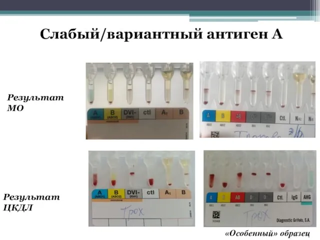 Слабый/вариантный антиген А Результат МО Результат ЦКДЛ «Особенный» образец