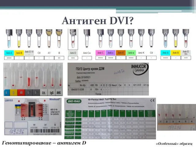 Антиген DVI? «Особенный» образец Генотипирование – антиген D