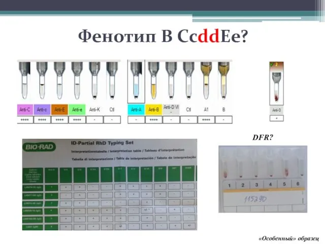 Фенотип B СсddEe? «Особенный» образец DFR?