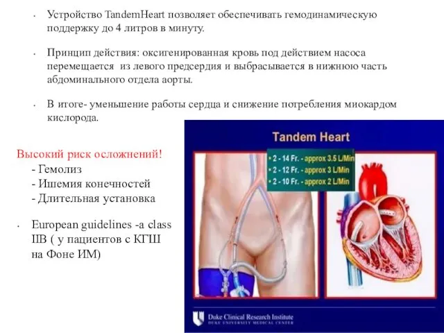 Устройство TandemHeart позволяет обеспечивать гемодинамическую поддержку до 4 литров в минуту.