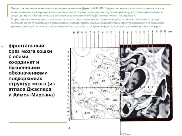 Стереотаксическая техника как метод исследования функций ЦНС. Стереотаксическая техника применяется для