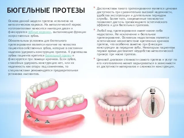 БЮГЕЛЬНЫЕ ПРОТЕЗЫ Достоинством такого протезирования является ценовая доступность при сравнительно высокой