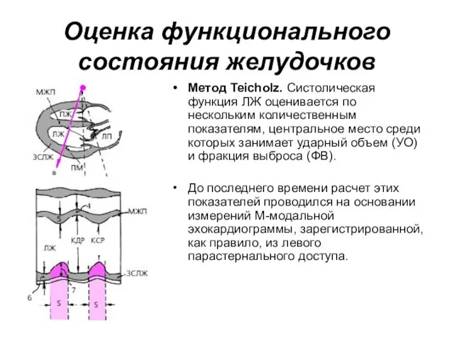 Оценка функционального состояния желудочков Метод Teicholz. Систолическая функция ЛЖ оценивается по