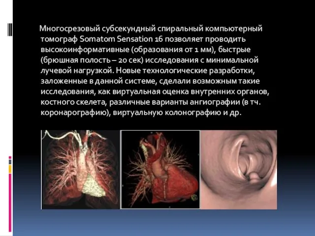 Многосрезовый субсекундный спиральный компьютерный томограф Somatom Sensation 16 позволяет проводить высокоинформативные