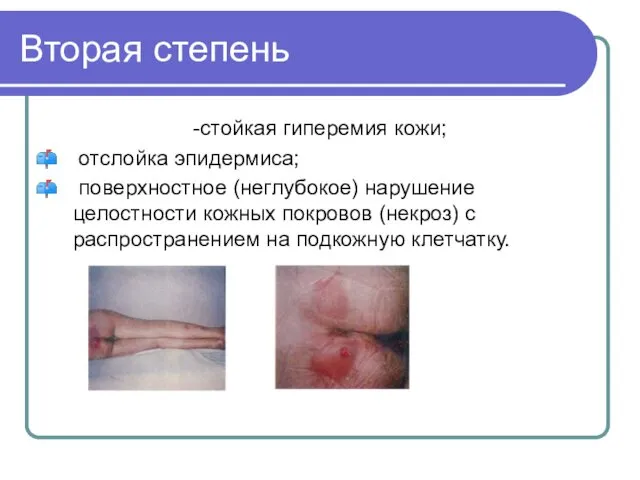 Вторая степень -стойкая гиперемия кожи; отслойка эпидермиса; поверхностное (неглубокое) нарушение целостности