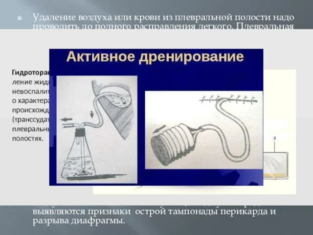 Удаление воздуха или крови из плевральной полости надо проводить до полного